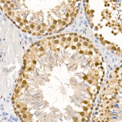 Immunohistochemistry-Paraffin: ATR [p Ser428] Antibody - Azide and BSA Free [NBP3-05447]